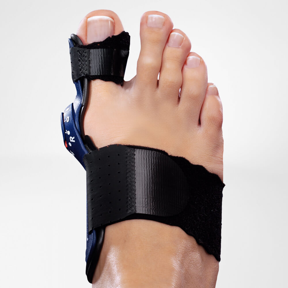 Vbočený palec (hallux valgus)